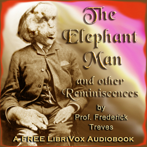 The Elephant Man and other reminiscences - Frederick TREVES